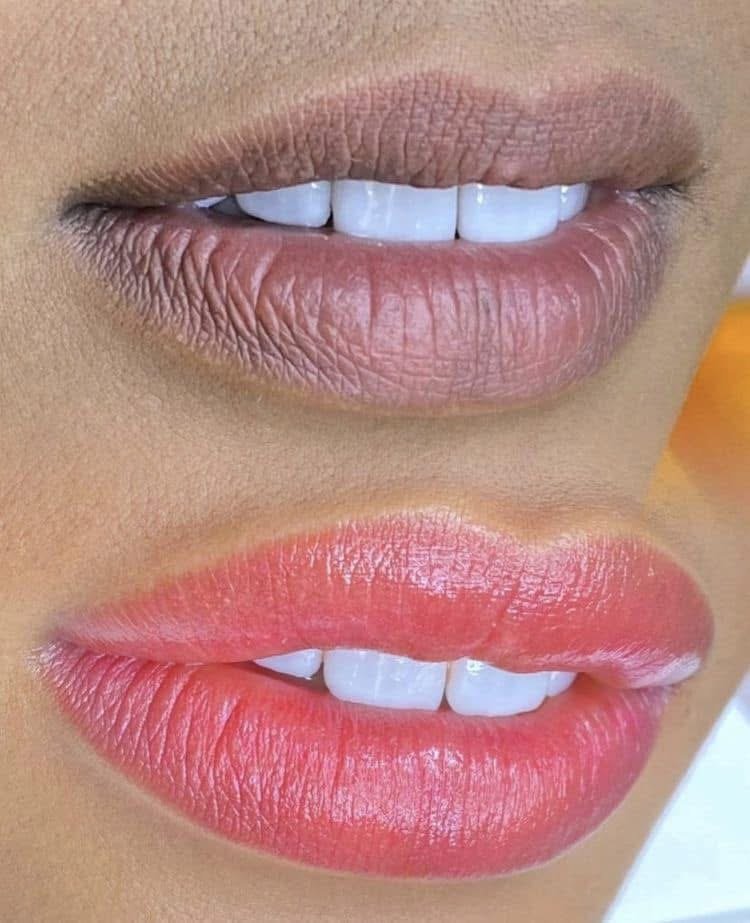 Lippigmentatie voor en na resultaat / lip pigmentation before and after